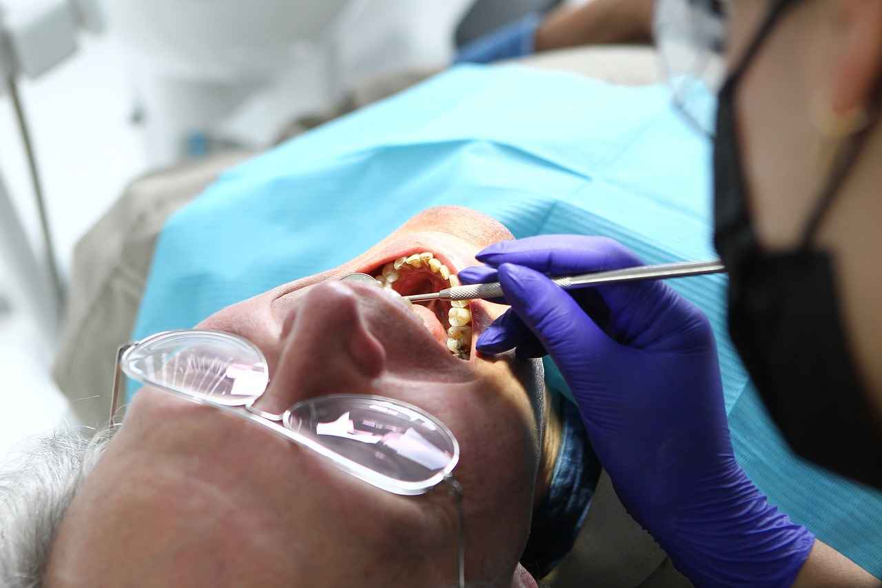 How to Prepare for Your Crown Appointment?