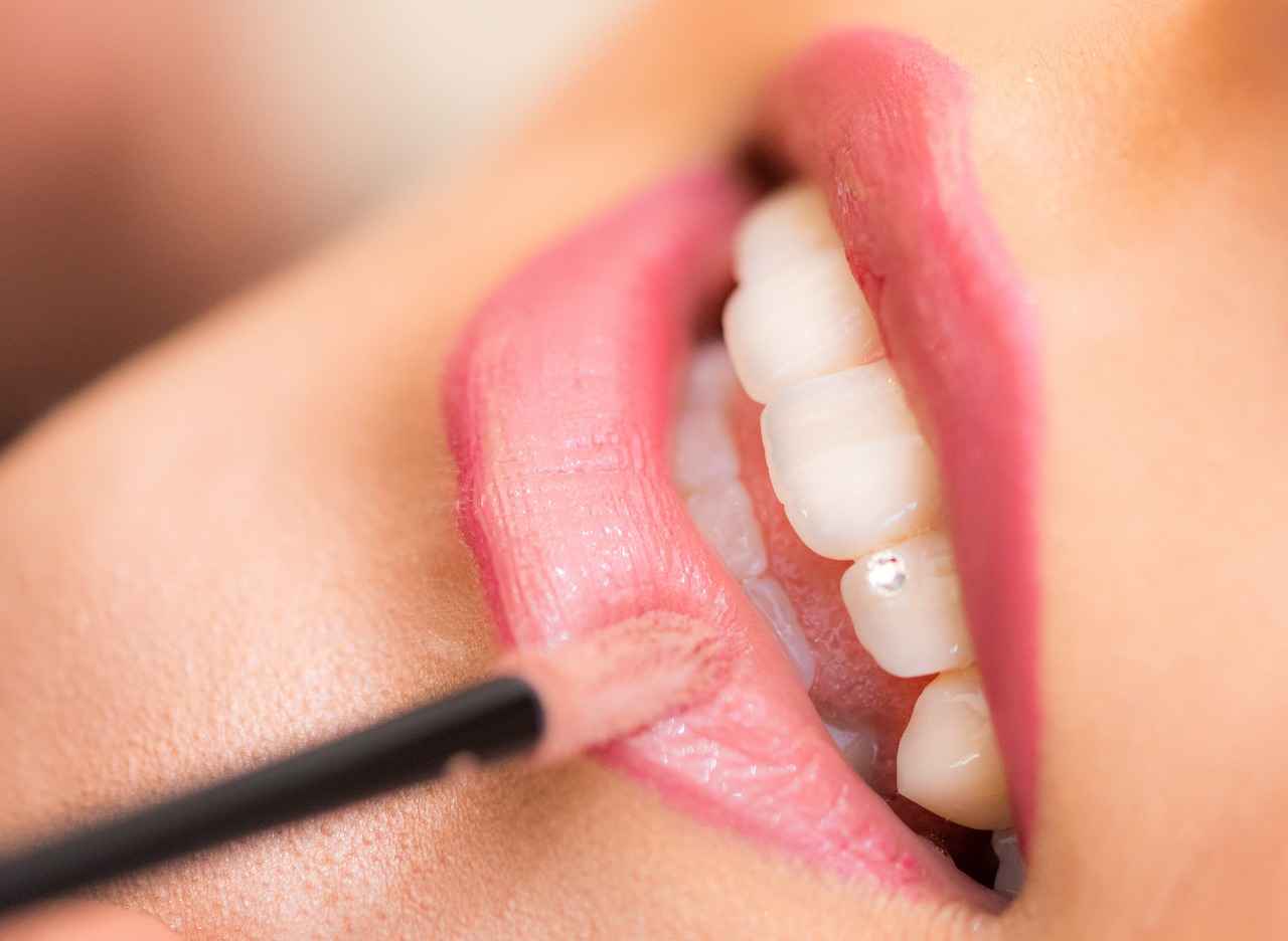 What is a Dental Crown and Why is it Needed?